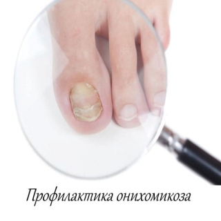 Профилактика онихомикоза - грибкового заболевания ногтей